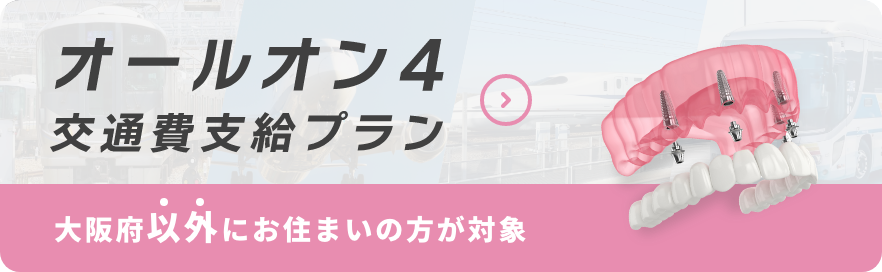 オールオン4交通費支給プラン大阪府以外にお住まいの方が対象